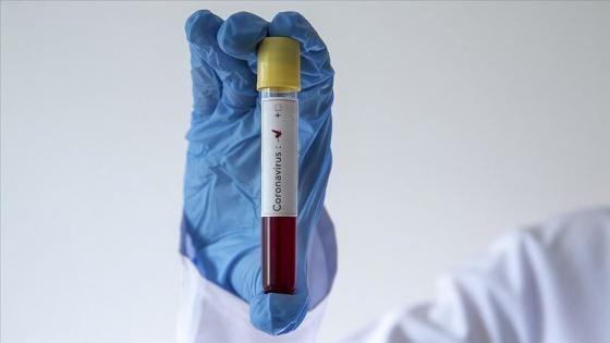المغرب يعلن عن تسجيل أول حالة إصابة بفيروس كورونا المستجد